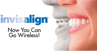 Invisalign